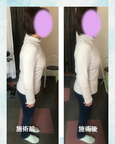 施術前6.png