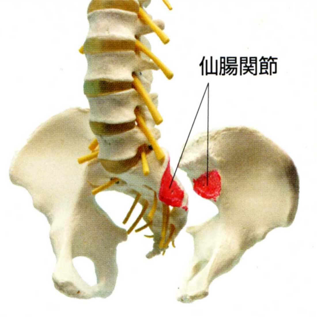 ぎっくり腰の原因箇所:仙腸関節の歪み,仙腸関節障害調整法で１０秒で完治。