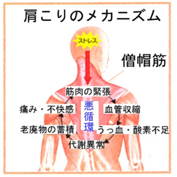 慢性的な首 肩 肩甲骨回りのコリの改善方法 新柏誠心整体ぎっくり腰一発解消専門整体 世界に誇れるギックリ腰一発完治法の確立