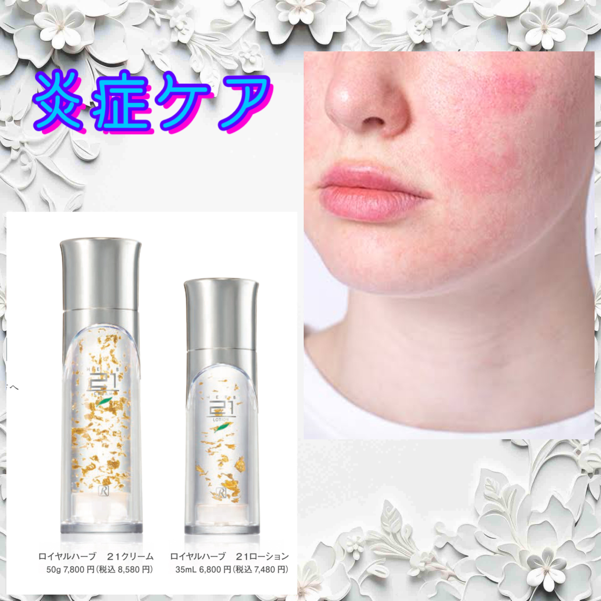 花粉症、アトピー性皮膚炎、日焼けなどの炎症ケア　ブログにて限定公開致しました。
