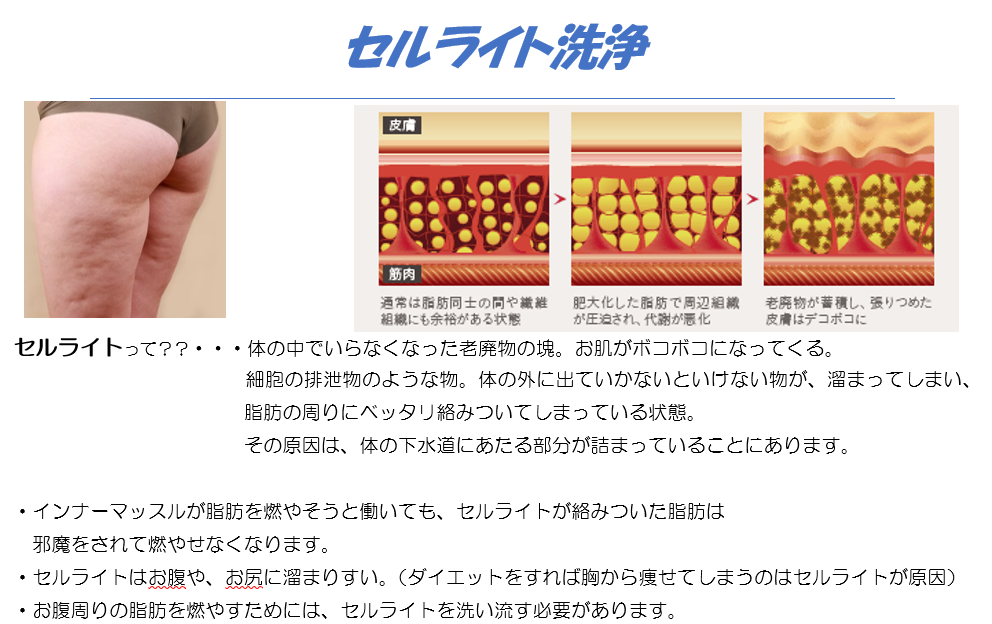 2017-05-09 (3).png