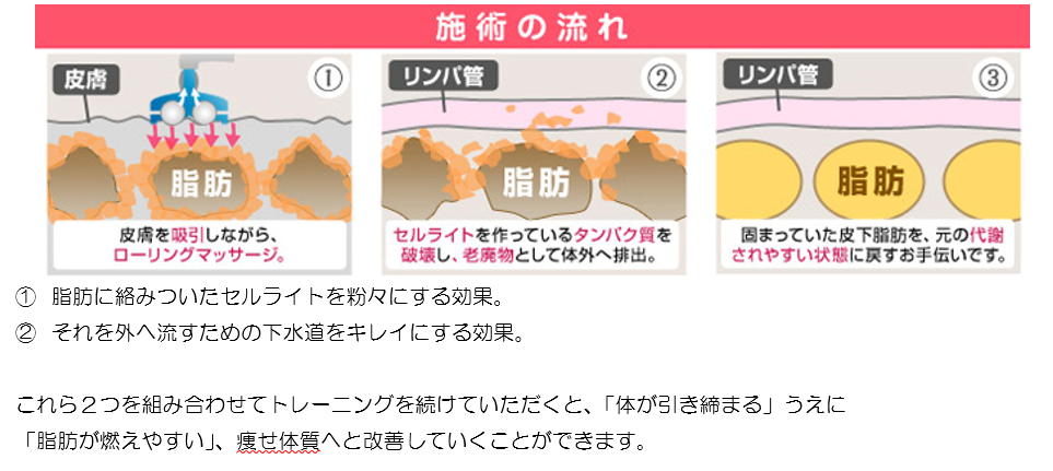 2017-05-09 (4).png