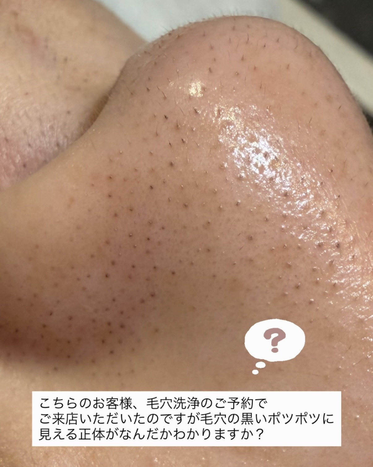 毛穴洗浄×フェイスワックス