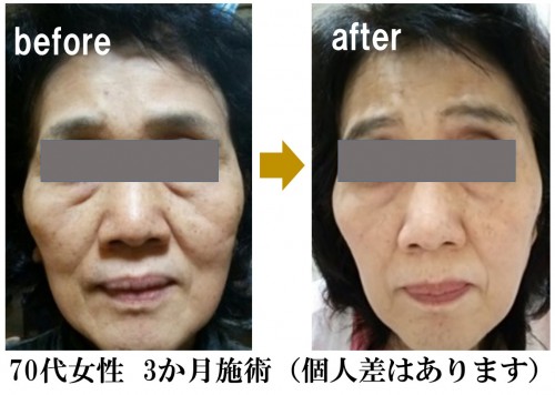 hpオープニング用あげ顔写真➁.jpg