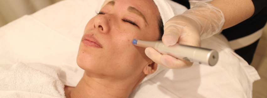 リゼネレート×ヒト幹細胞培養液