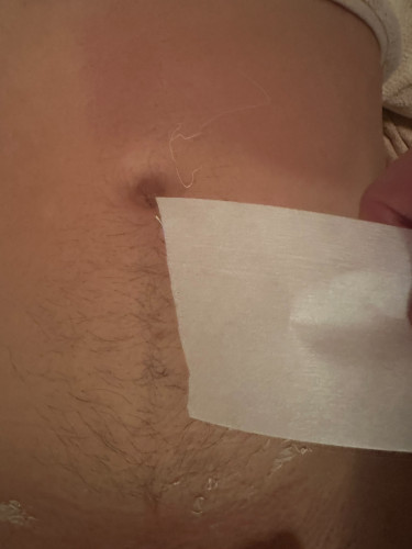 ３月は脱毛が増える季節ですね。