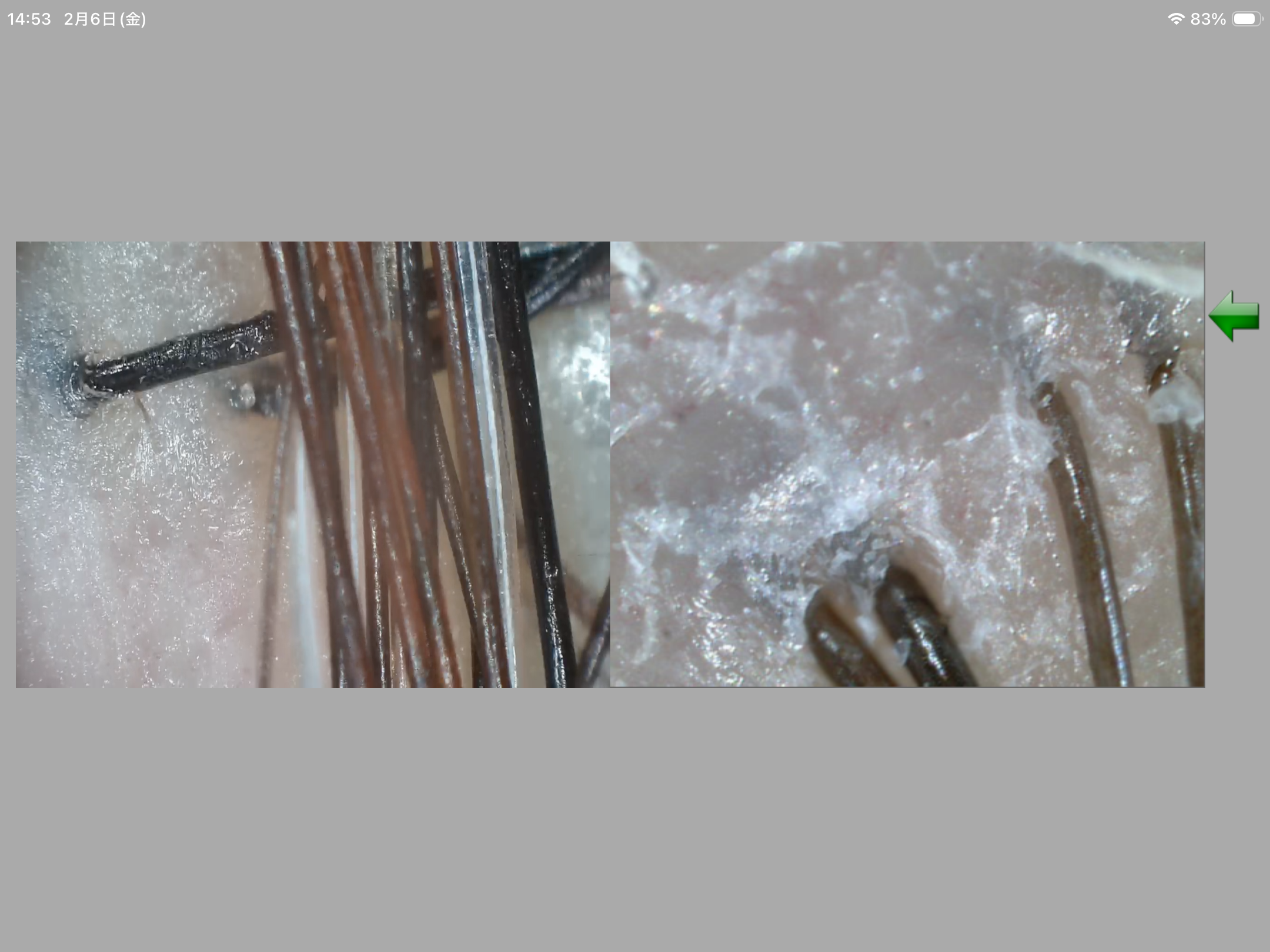 マイクロスコープ頭皮診断＋おうちケアアドバイス