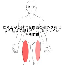 股関節痛 口コミ1位 国際整体療術院 群馬県伊勢崎市 腰痛 首痛 骨盤 顎関節