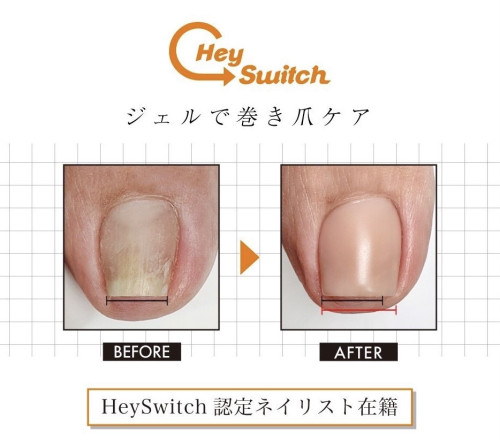≪特許取得☆巻き爪ケア≫　フットジェルネイル
