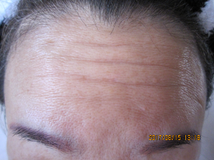 しわのばしテ&minus;プ