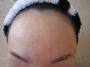 しわのばしテ&minus;プ