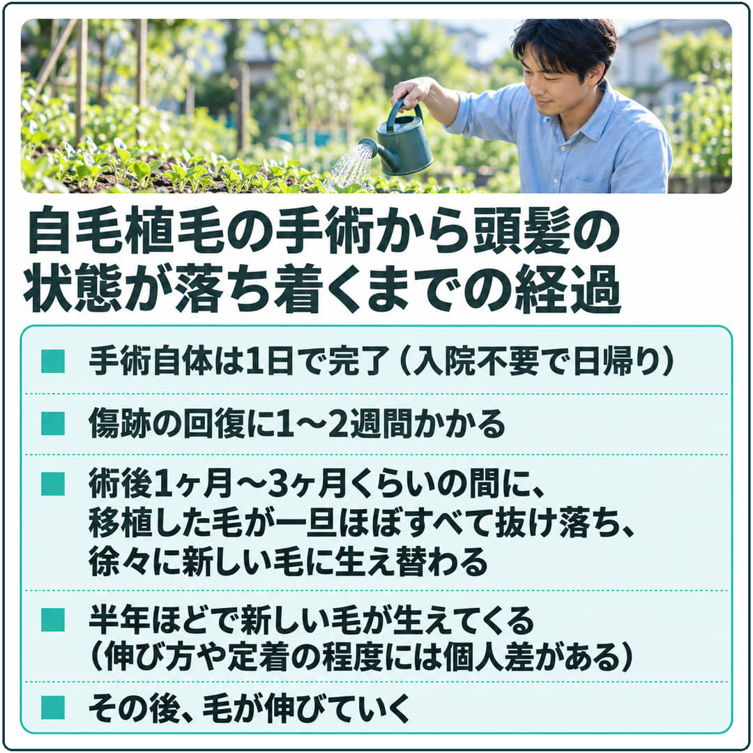 自毛植毛の手術から頭髪の状態が落ち着くまでの経過を5段で示した図。移植した毛は術後1ヶ月～3ヶ月くらいの間に一旦ほぼすべて抜け落ち、半年ほどで新しい毛が生えてくる（個人差がある）