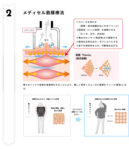 ②筋膜flow_02.png
