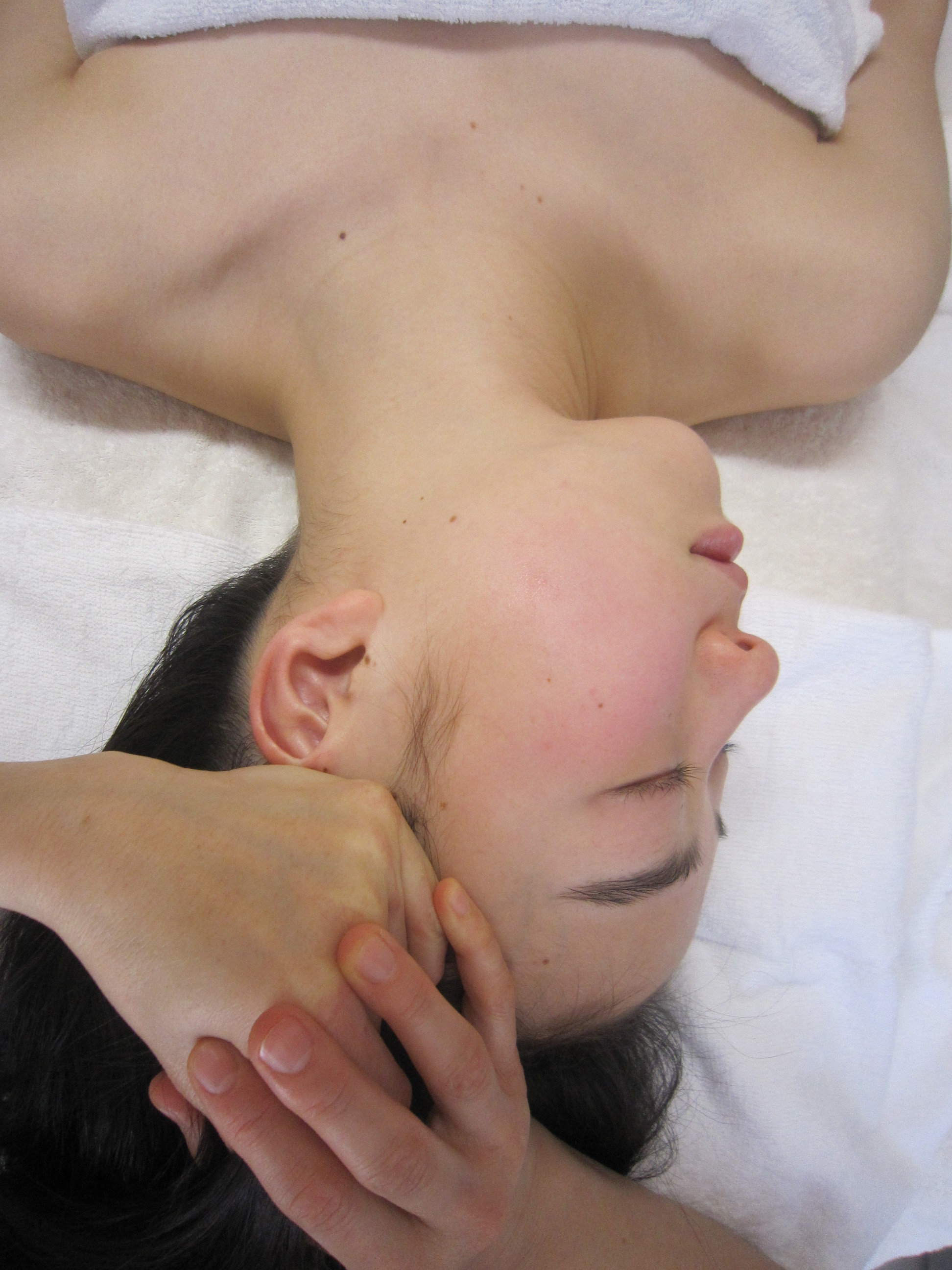 たるみを引き上げ、フェイスラインをシャープに引きしめます。人気メニューです。