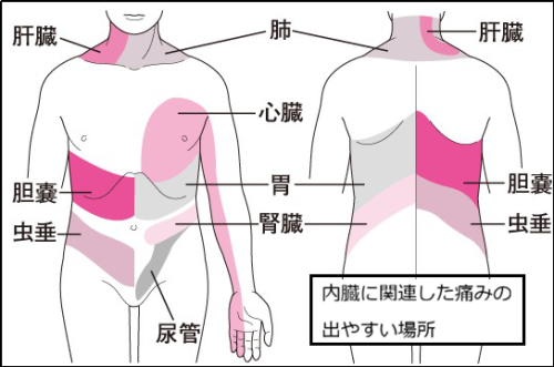 体幹の痛みブログ.png