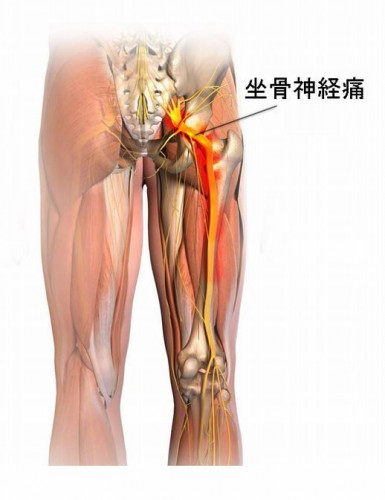 座骨神経痛の鍼治療、坐骨神経の流れ