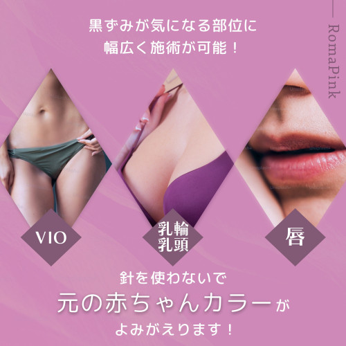 ローマピンクとは.jpg