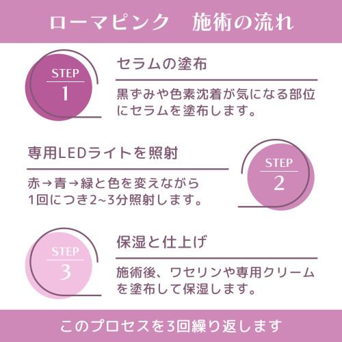 施術の流れ1.jpg