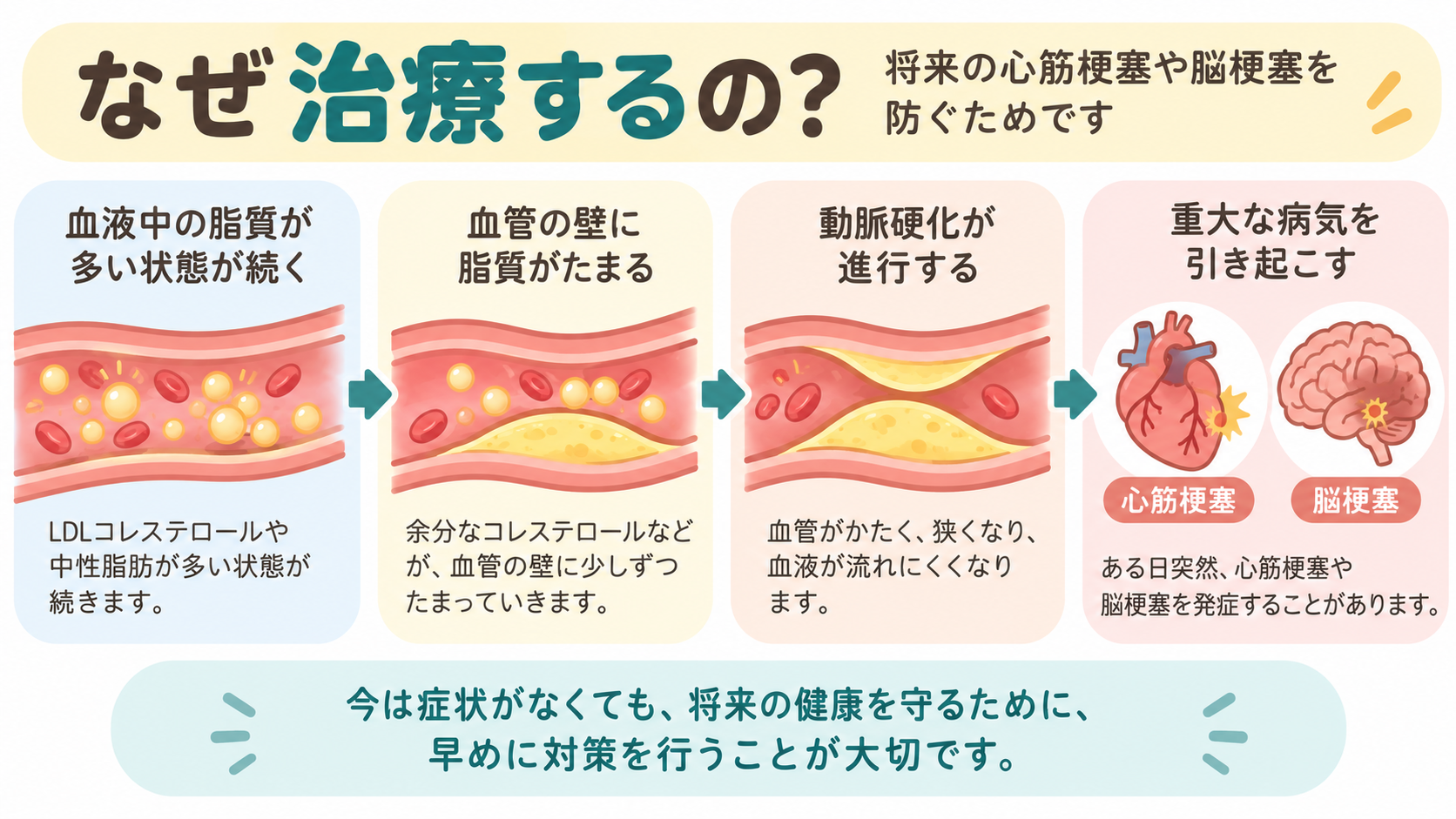 脂質異常症はなぜ治療するの