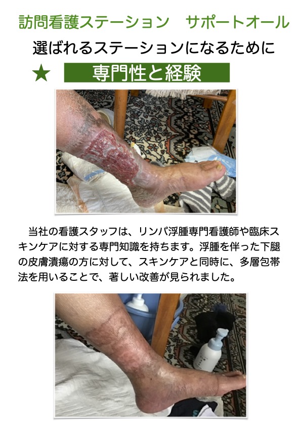 臨床スキンケア看護師がいます