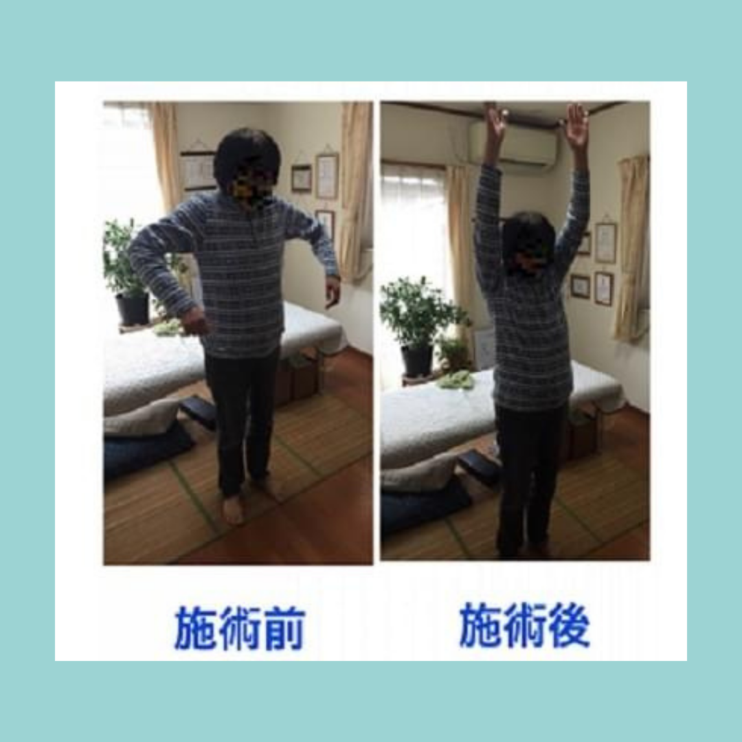 施術ビフォーアフター