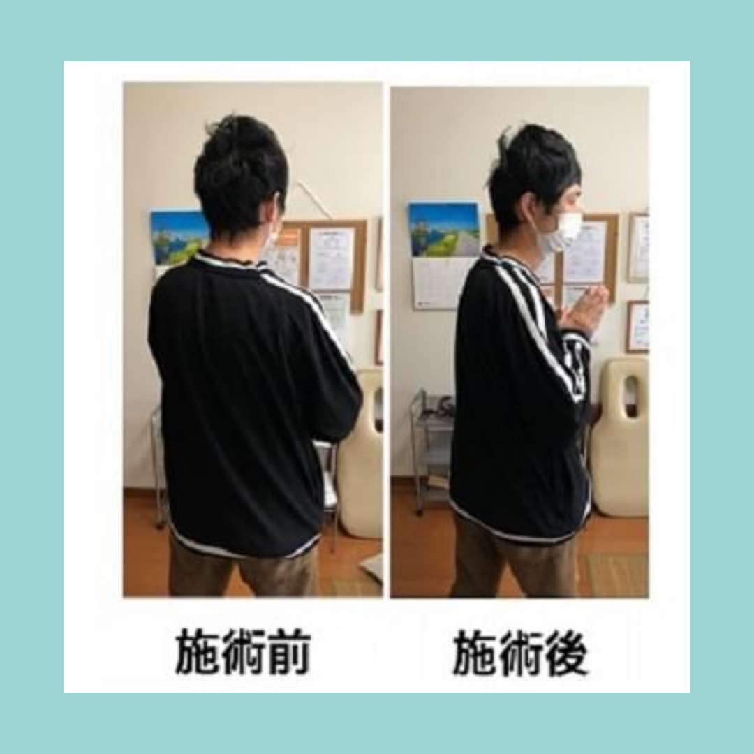 施術ビフォーアフター