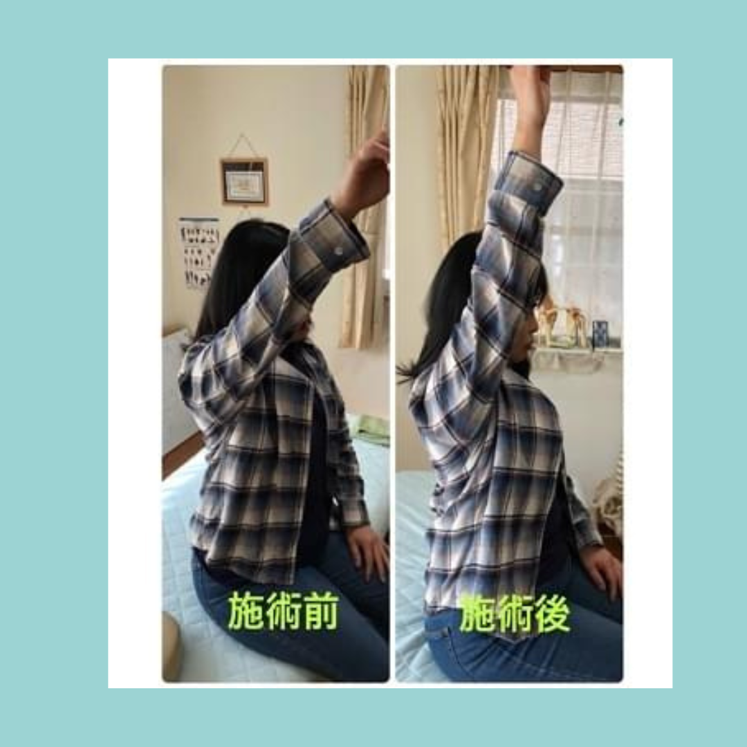 施術ビフォーアフター