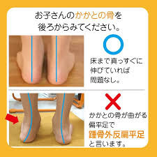 足首 正常 外反足.jpeg