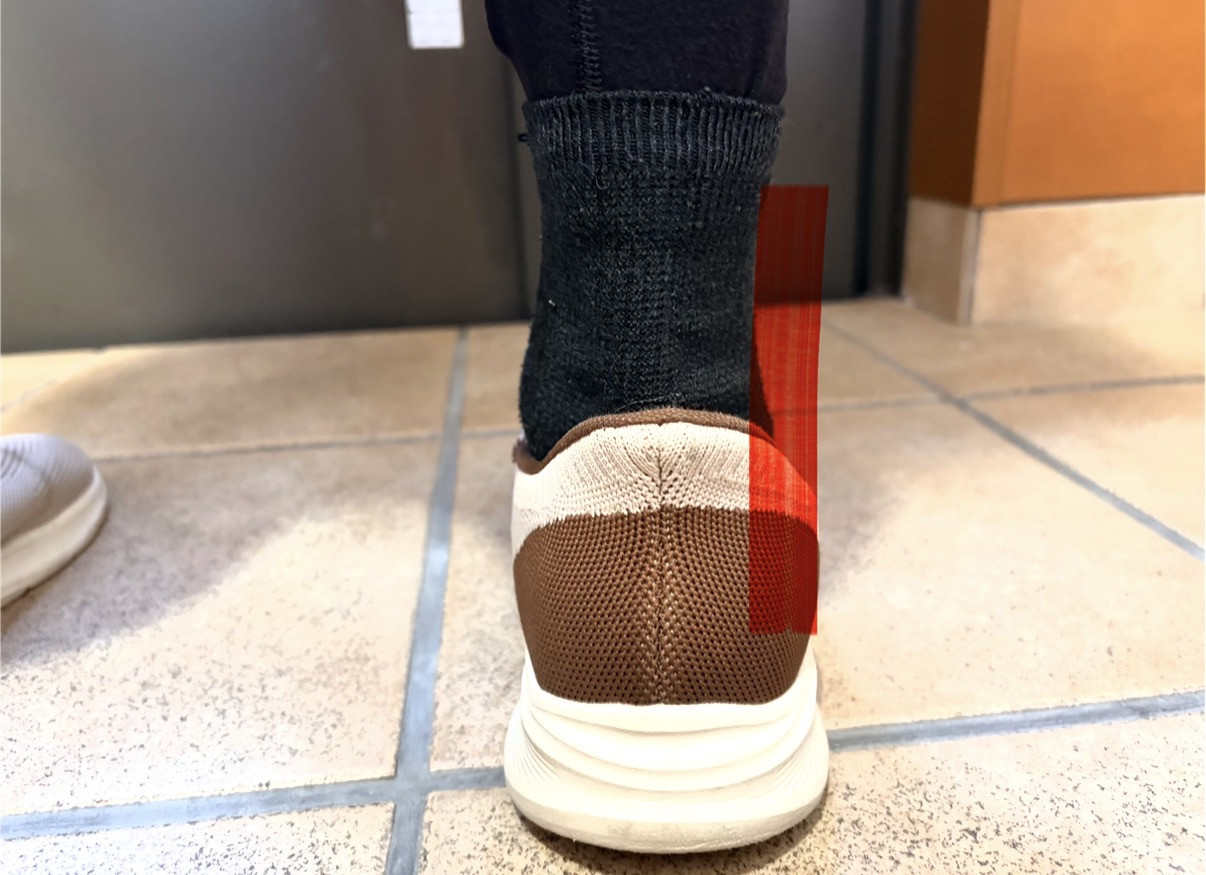 フットサポート（after）