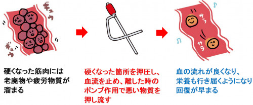 虚血圧迫法イメージ.png