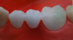 白い歯 (2).jpg