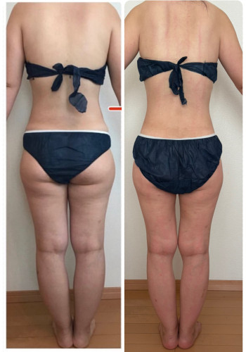 30代以降はマシンの力を借りるべし