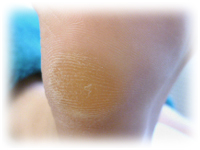 menu_footcare_img5.jpg