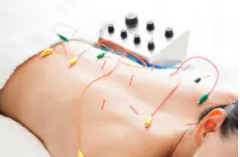 電気鍼(パルス・低周波鍼通電療法)