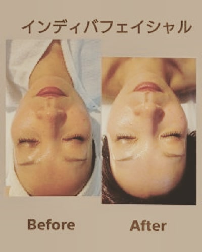 インディバ　フェイシャル💆