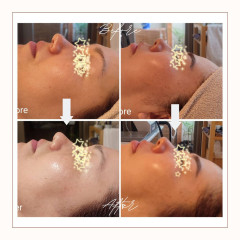 Ivory Minimalist Before and After Skincare Beauty Instagram Post.jpg