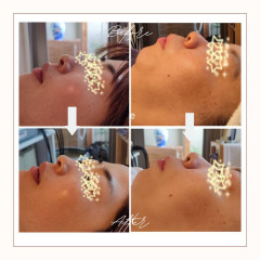 Ivory Minimalist Before and After Skincare Beauty Instagram Post (1).jpg