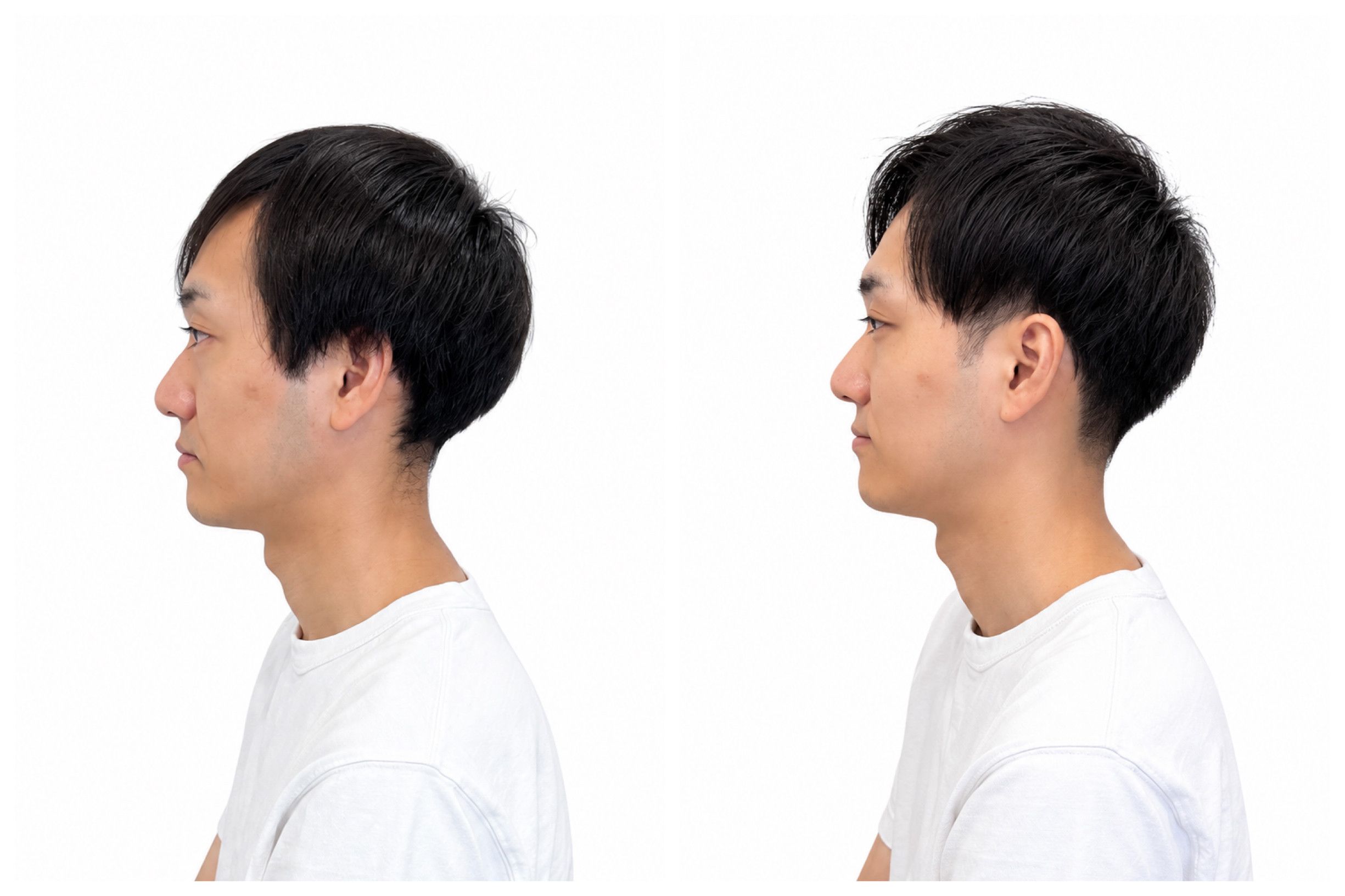 ヘアスタイル写真