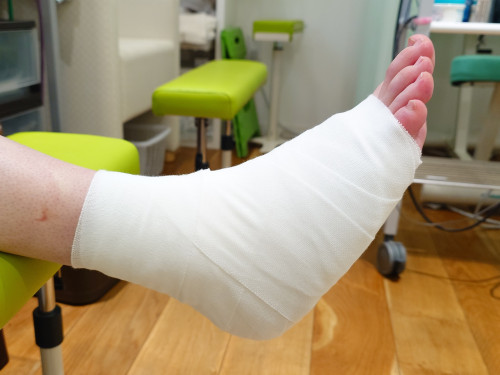第5中足骨骨折　圧迫固定包帯