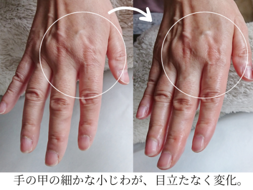 【春の乾燥予防】ビタミンEたっぷり!オーガニック*オリーブSPAオイルで、しっとりすべすべな指先へ。