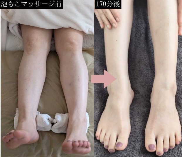 【泡もこ170分モニターご感想】施術時の力加減が絶妙で、クセになります。