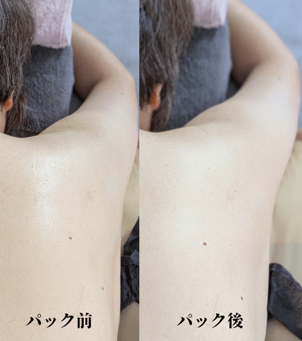 【快眠めぐりケア ご感想】ふだん手の届きにくい背中が、しっとり良い感じです♪