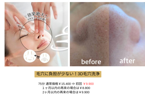毛穴に負担が少ない！毛穴洗浄.png