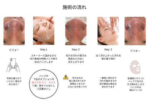 毛穴に負担が少ない！毛穴洗浄 (1).png