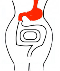 胃のコピー.jpg