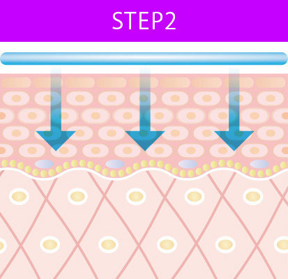 STEP2.jpg