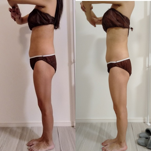 痩身コース　10回