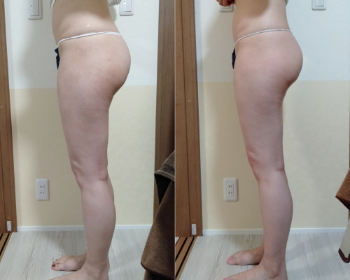 痩身メソッド　小尻　5回