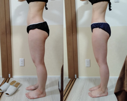 太腿　ヒップアップ