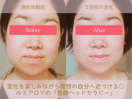 4：3HPBビフォーアフター2.png